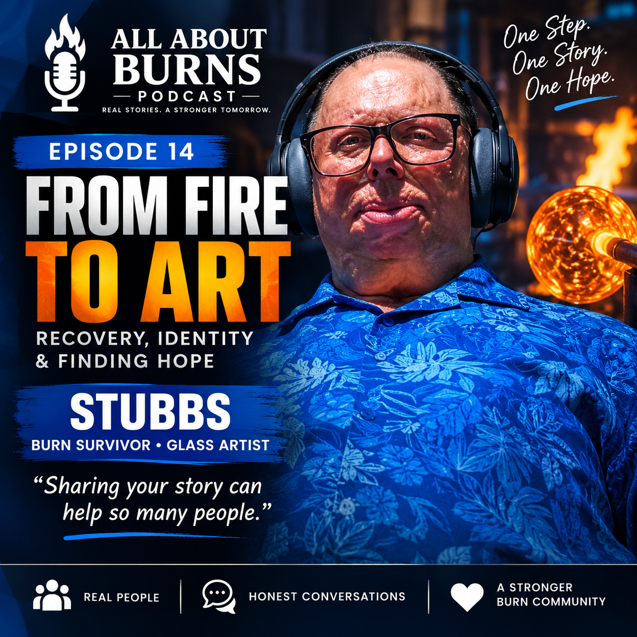 From Fire to Art: Burn Survivor Stubbs’ Journey of Resilience and Hope