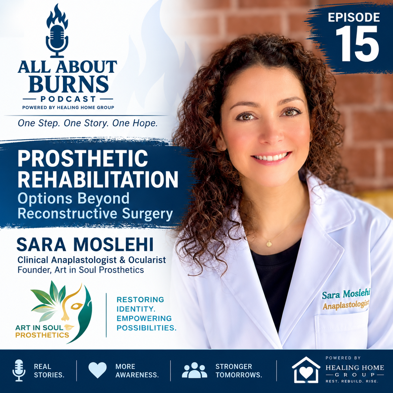Restoring Confidence: The Power of Anaplastology for Burn Survivors