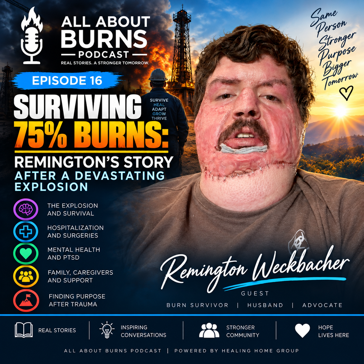 Surviving 75% Burns: Remington’s Story After a Devastating Explosion